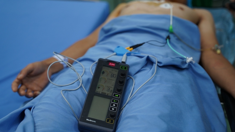 máy tạo nhịp tim tạm thời - Giải pháp lấy lại nhịp tim ổn định 2