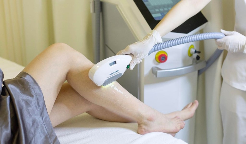 Máy triệt lông không lên nguồn là do đâu? Các lỗi thường gặp khác 3