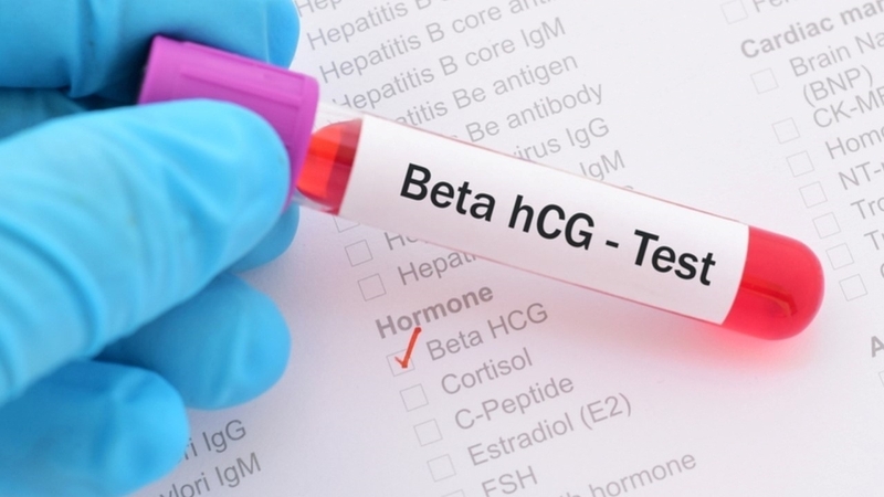 Mấy tuần thì biết thai ngoài tử cung? Thai ngoài tử cung có thể được phát hiện sớm thông qua xét nghiệm Beta hCG