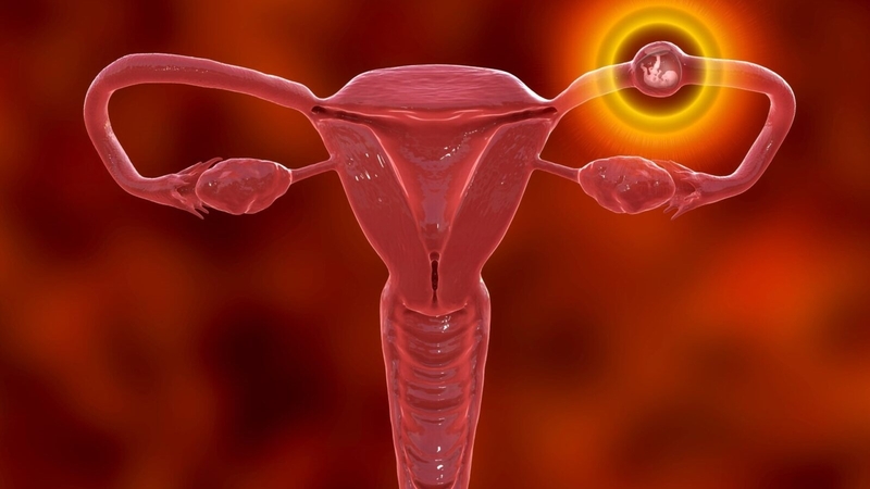 Có nhiều yếu tố làm tăng nguy cơ mang thai ngoài tử cung