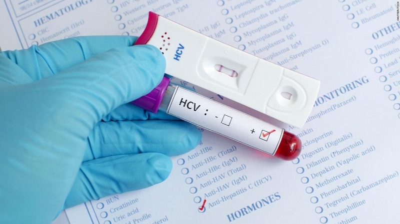 Mẹ bầu bị viêm gan C có nguy hiểm không? Tìm hiểu ngay những điều cần biết 4