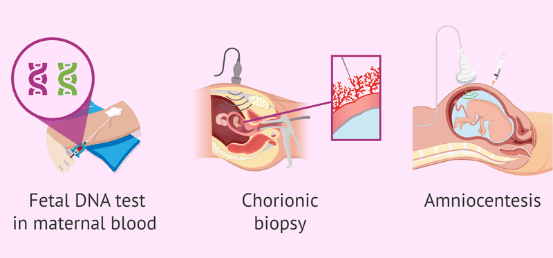 Mẹ bầu đang mang thai có xét nghiệm ADN được không? 2