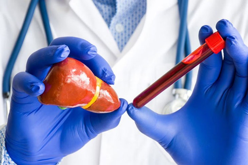 Chỉ số GOT là gì? Những điều bạn cần biết về chỉ số GOT 1