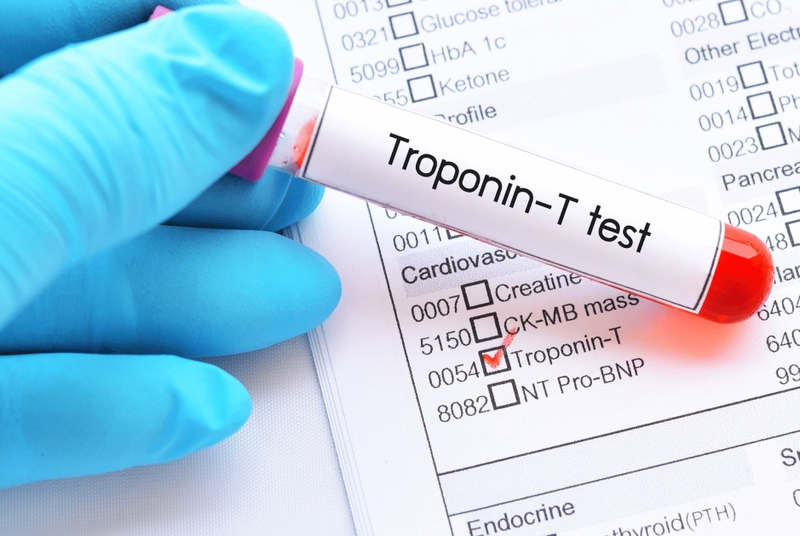 Men tim là gì? Phân loại và vai trò của men tim 5