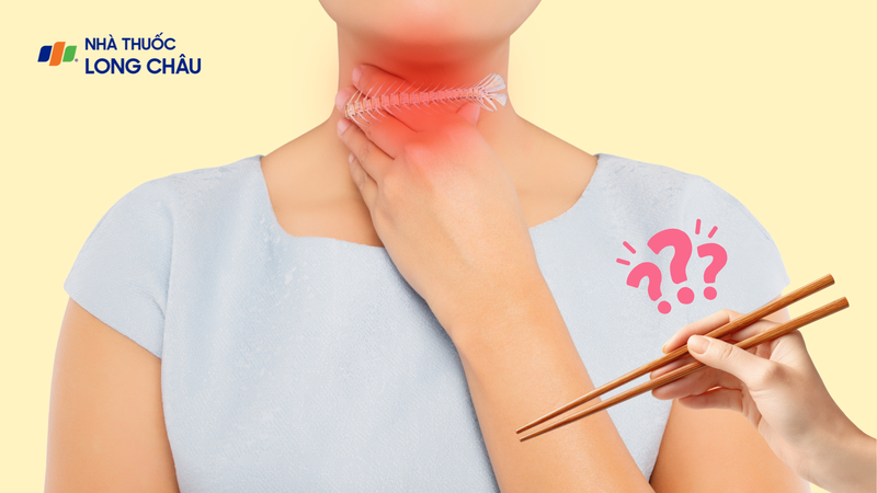 Mẹo chữa hóc xương cá bằng đũa là kinh nghiệm truyền miệng