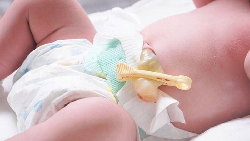 Mẹo dân gian khi trẻ rụng rốn không phải ai cũng biết 1