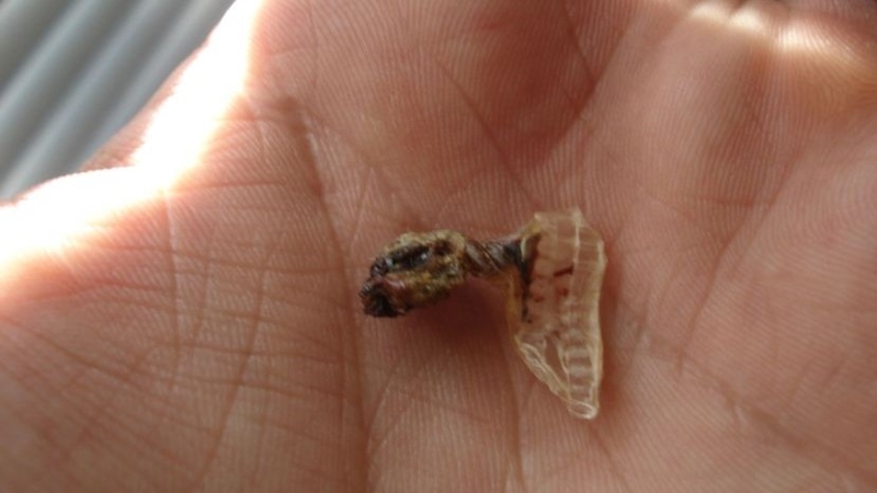 Mẹo dân gian khi trẻ rụng rốn không phải ai cũng biết 2