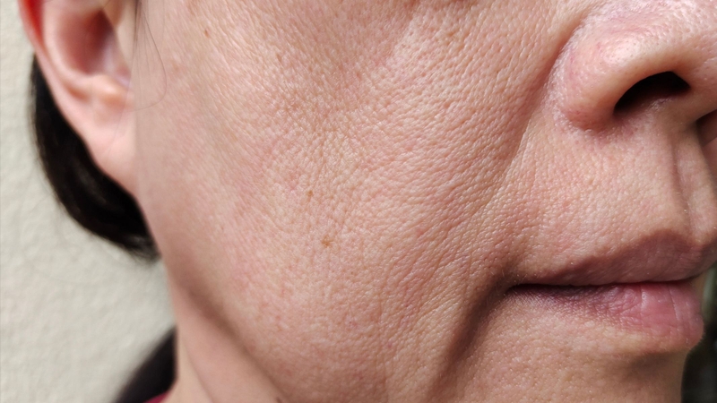 Mẹo hay: 5 giây kiểm tra mức độ lão hóa da 2