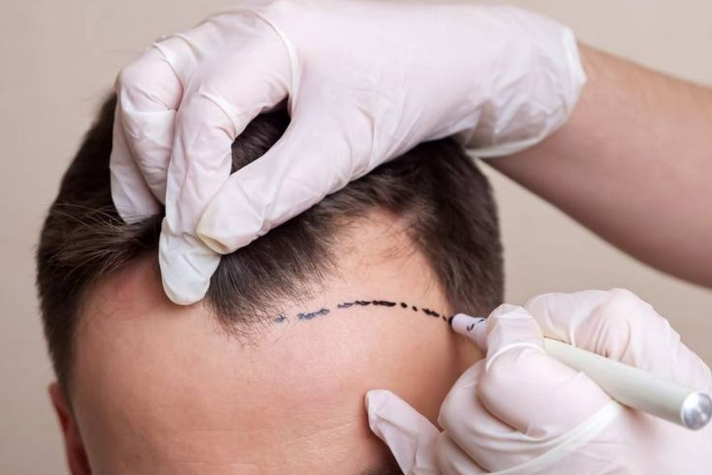 Mẹo khắc phục nhược điểm tóc bò liếm chỉ với vài thao tác 3