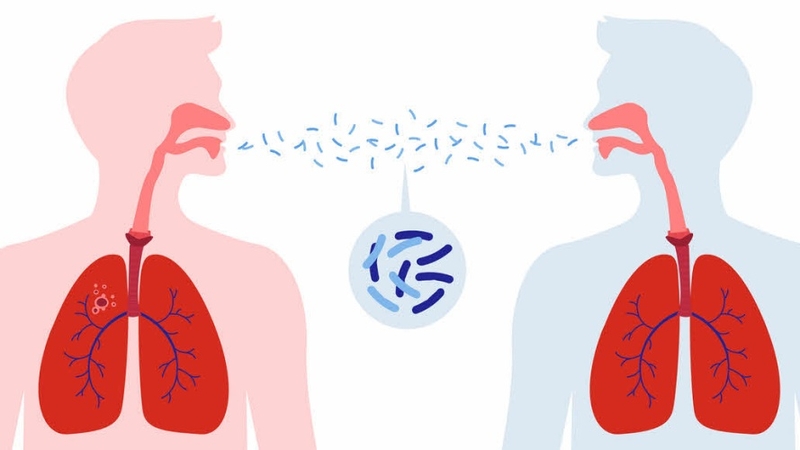 MERS có lây không? Cách phòng ngừa hiệu quả dịch bệnh nguy hiểm này 2