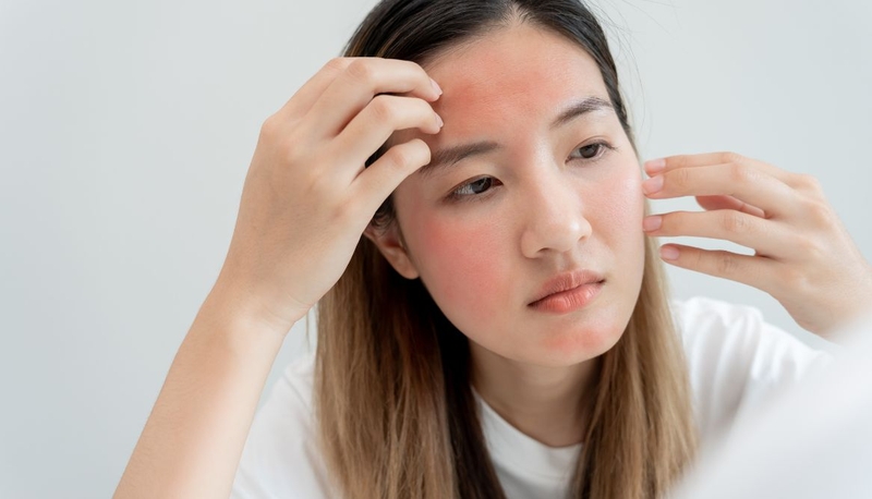 Meso botox là gì​? Lợi ích và rủi ro tiềm ẩn cần cân nhắc 4