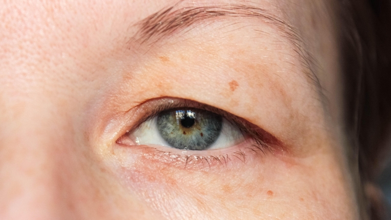 Mí mắt: Cấu tạo, chức năng và những bệnh lý thường gặp 4