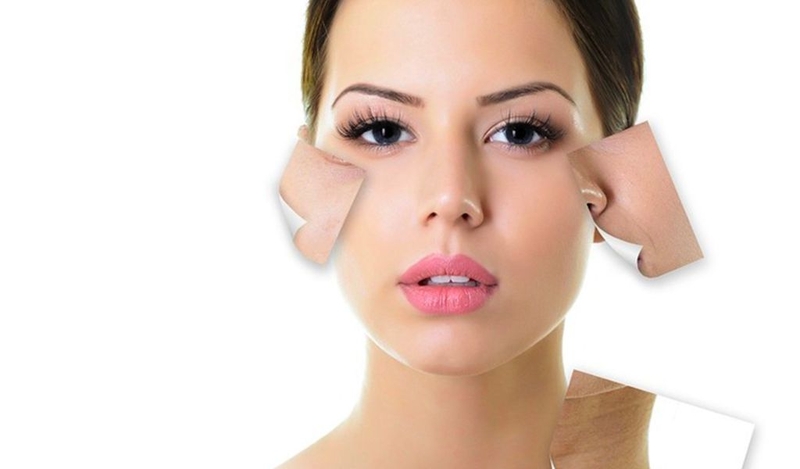 Microdermabrasion là gì? Cần làm gì trước và sau khi điều trị? 2