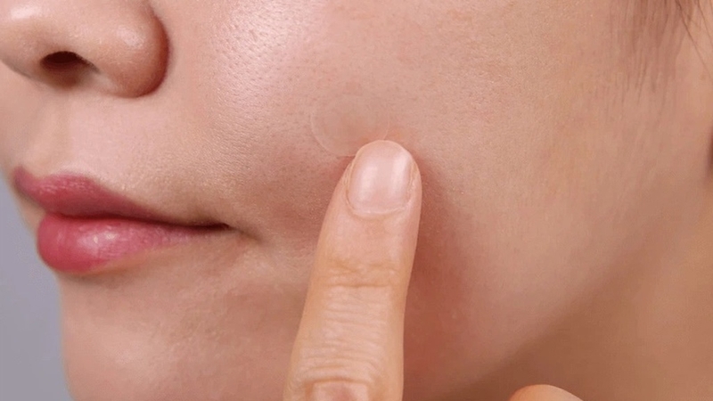 Miếng dán hút mụn ngày và đêm Derma Angel có tốt không? 2