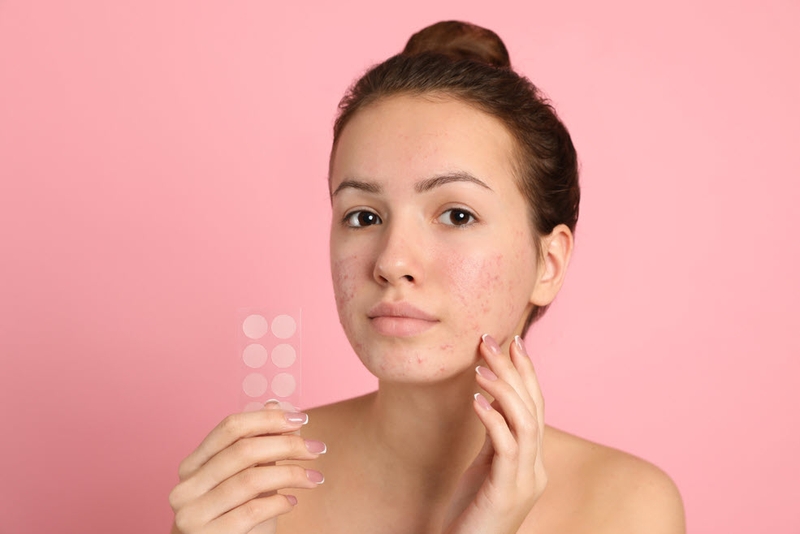 Miếng dán mụn có thật sự đem lại hiệu quả không? 4