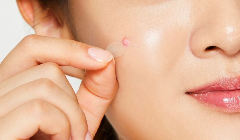 Miếng dán mụn Cosrx có tốt không? Nên dùng loại nào tốt? 1