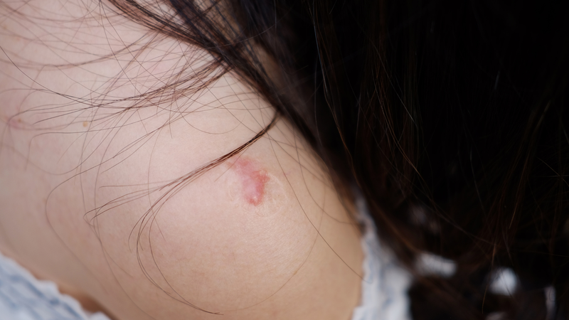 Điều trị sớm và đúng phương pháp giúp rút ngắn thời gian hồi phục