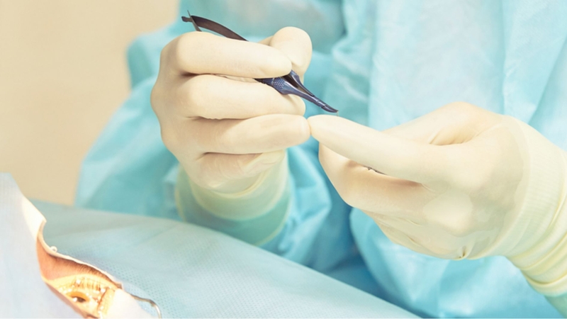 Mổ đục tinh thể bao lâu mới lành? Phụ thuộc vào nhiều yếu tố