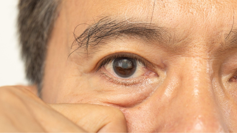 Nếu thị lực mờ hơn sau phẫu thuật, bạn nên đến chuyên khoa mắt để được thăm khám kịp thời