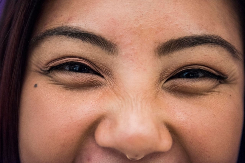 Mổ mắt cận có bị tái lại không - Làm gì để hạn chế tái cận? 2