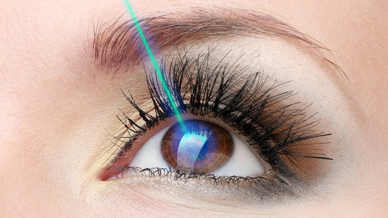 Lasik Surgery là gì? Một số đối tượng có thể thực hiện phẫu thuật mắt Lasik? 01