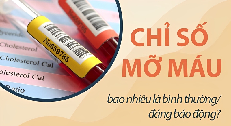 Mỡ máu cao bao nhiêu thì phải uống thuốc?2