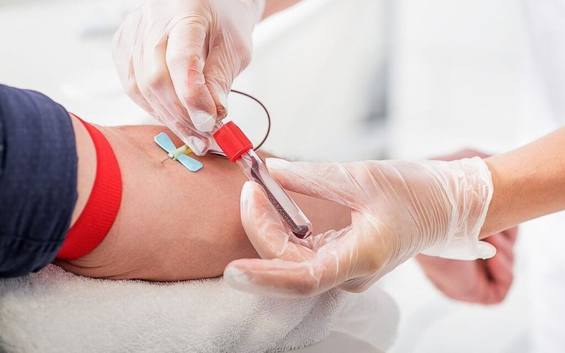 Mỡ máu gia đình: Dấu hiệu nhận biết, phương pháp chẩn đoán và hướng điều trị 3