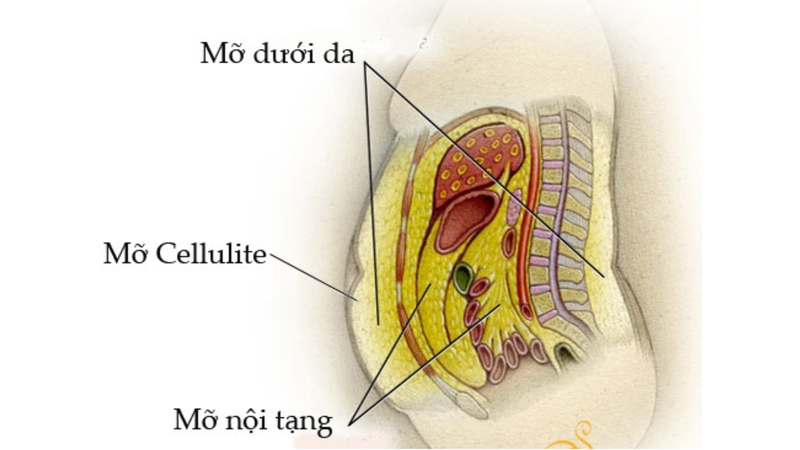Mỡ nội tạng tích tụ - Dấu hiệu cảnh báo sức khỏe bạn cần biết 3