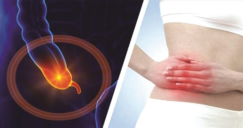 Mổ ruột thừa rồi có bị lại không? 1