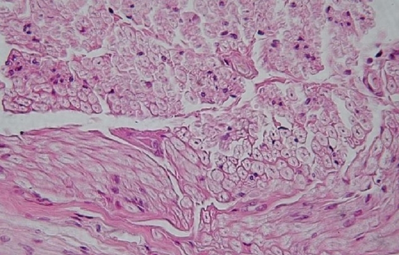 Mô thần kinh có chức năng gì? Biện pháp để duy trì hệ thần kinh luôn khỏe mạnh 3