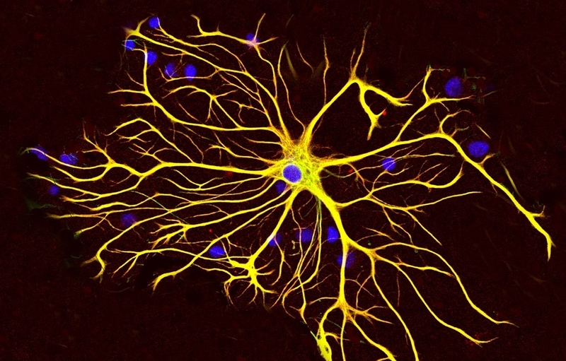 Mô thần kinh có chức năng gì? Biện pháp để duy trì hệ thần kinh luôn khỏe mạnh 4