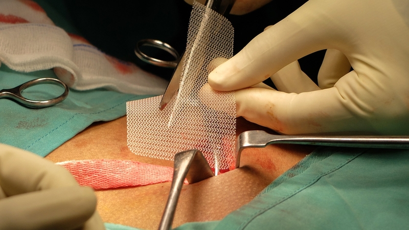 Mổ thoát vị bẹn ở đâu tốt nhất? Nên làm gì sau mổ? 2