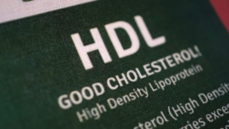 Mối liên hệ giữa chất lượng cholesterol HDL và nguy cơ mắc bệnh Alzheimer 1