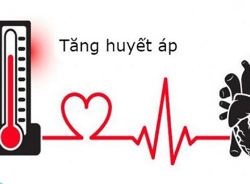 Mối liên hệ giữa tăng huyết áp và xuất huyết não không phải ai cũng biết 1