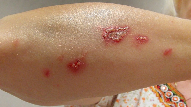 Mối nguy hiểm với kiến ba khoang trong mùa mưa 1