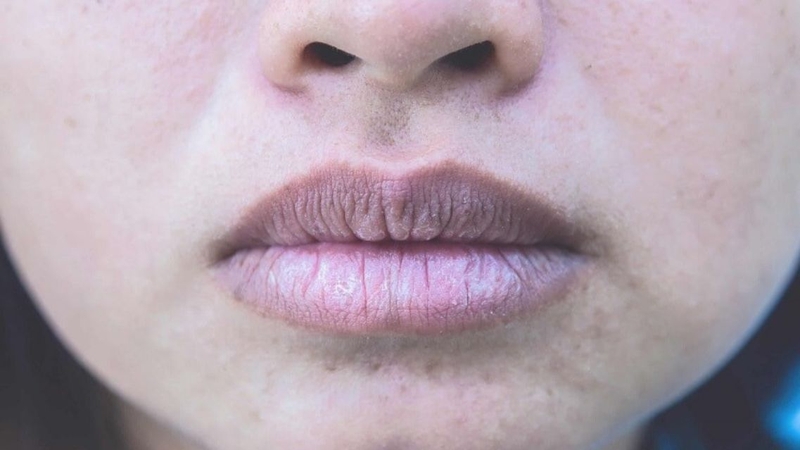 Nhiều người vẫn chưa biết&nbsp;môi thâm nên dùng son màu gì&nbsp;phù hợp