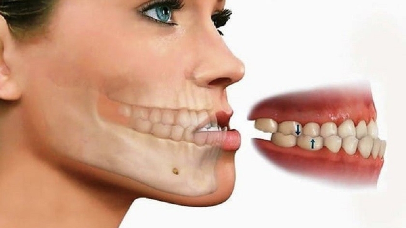 mom-nhe-va-cac-phuong-phap-dieu-tri-hieu-qua 1