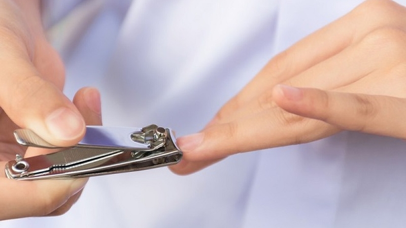 Móng tay bị hư và cách xử lý an toàn, hiệu quả 1