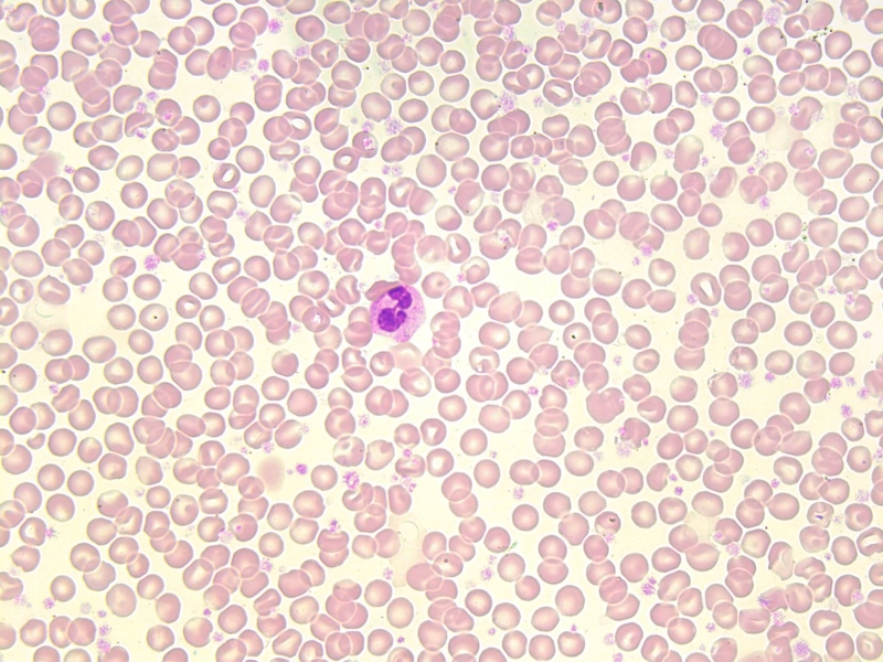 Mono là gì Xét nghiệm bạch cầu mono có ý nghĩa gì 2