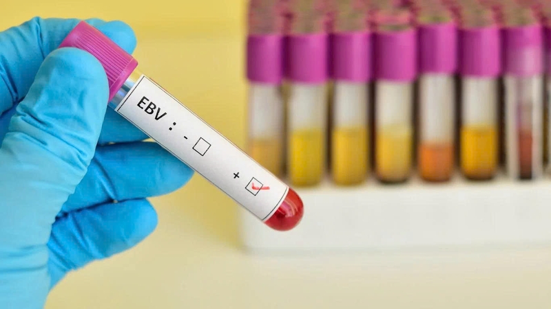 Mono trong xét nghiệm máu là gì? Hướng dẫn hiểu kết quả cho người mới 1