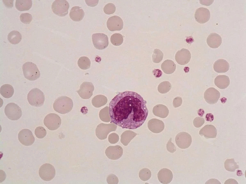 Mono trong xét nghiệm máu là gì? Hướng dẫn hiểu kết quả cho người mới 3