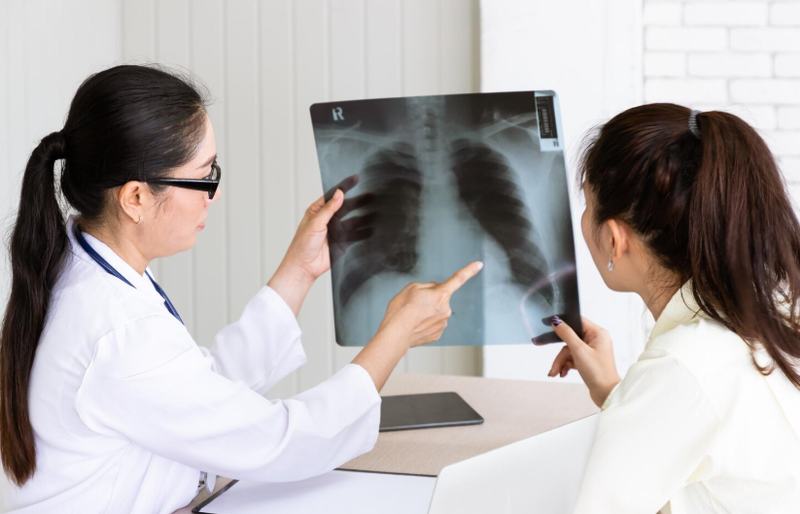 Mono trong xét nghiệm máu là gì? Hướng dẫn hiểu kết quả cho người mới 4