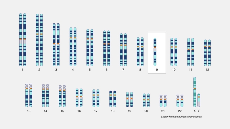 Monosomy: Biểu hiện, triệu chứng và cách điều trị1
