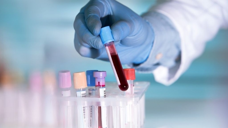 Morgellons là bệnh gì? Nguyên nhân và cách điều trị bệnh? 4