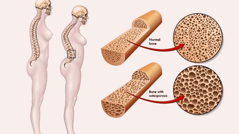 Một ngày nên ăn bao nhiêu quả táo đỏ khô? Lợi ích của táo đỏ khô đối với sức khỏe ra sao? 3
