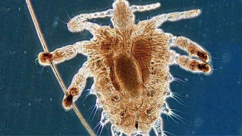 Một số hình ảnh ngứa vùng kín 1