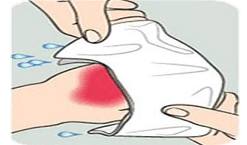 Sử dụng gạc che vết bỏng