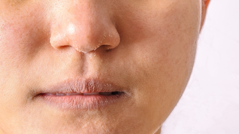 Người có làn da khô nên bổ sung trái cây giàu vitamin E