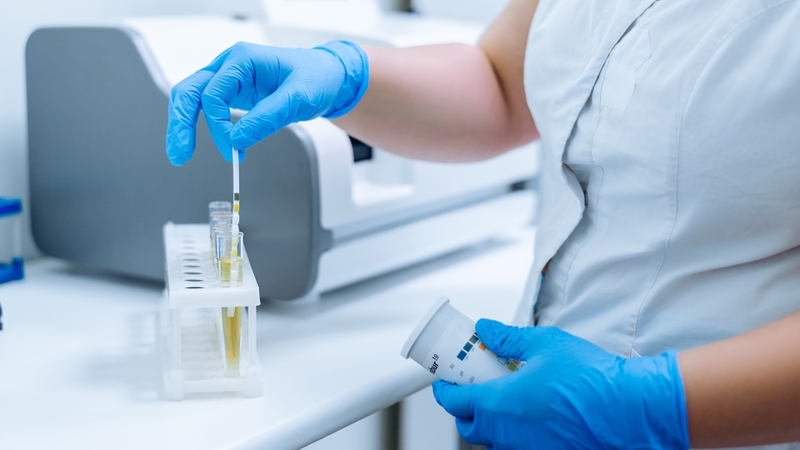 Một số nguyên nhân bị suy thận mà bạn cần biết 3