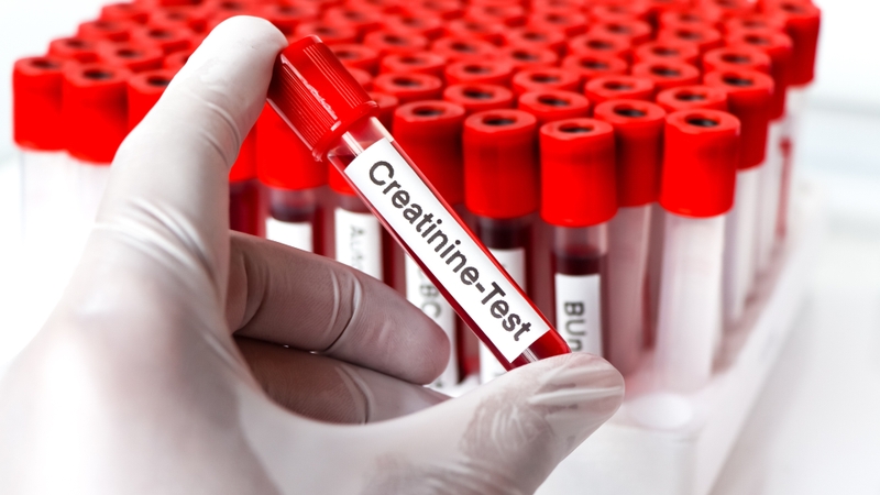 Khi nồng độ creatinine tăng cao, đó có thể là dấu hiệu của suy giảm chức năng thận